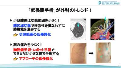�X���C�h
