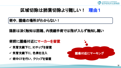 �X���C�h