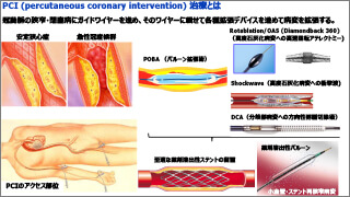 MICS pscheme